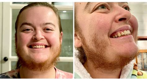 Woman Says She S Free After Ditching Razor To Let Beard Grow