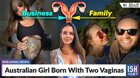 Australian Girl Born With Two Vaginas Ish News Youtube