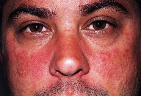 Your Face: A Window Into Your Health