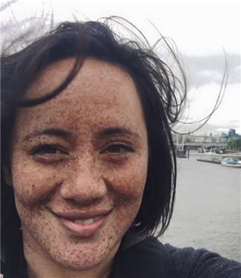 Mom Bullied For Contagious Freckles Finally Embraces Self See Her