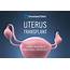 Cleveland Clinic To Study Uterus Transplants  HealthBeat