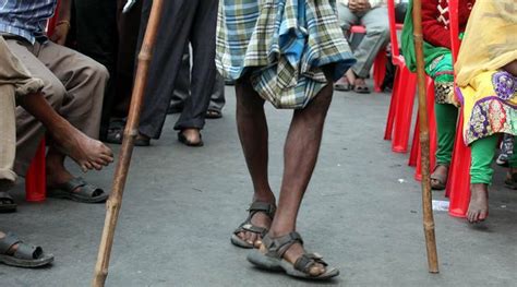 Supreme Court 3 Per Cent Quota For Disabled Must In All Posts India
