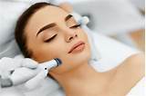 Images of What Do Microdermabrasion Treatments Do