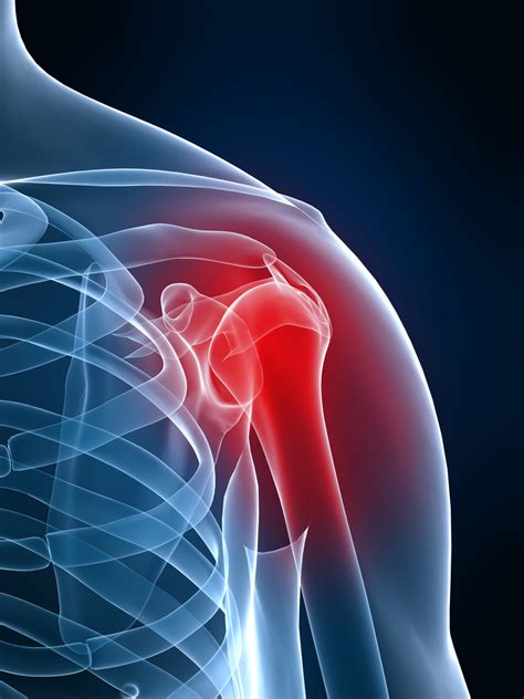 Shoulder Injury And Neck Injury Workers Compensation Center