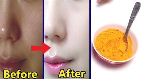 How To Get Fair Skin In Just 1 Days Remove Sun Tan From Face And Body