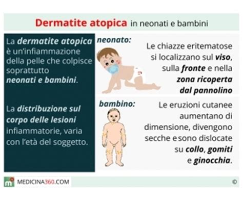 Dermatite Atopica In Bambini E Neonati Cause Rimedi Ed Alimentazione