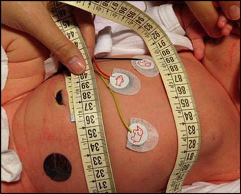 Frontiers Reference Values For Abdominal Circumference In Premature