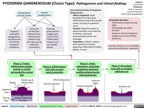 Pyoderma Gangrenosum Pathogenesis And Clinical Findings Calgary