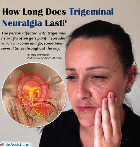 We did not find results for: How Long Does Trigeminal Neuralgia Last? | Trigeminal ...
