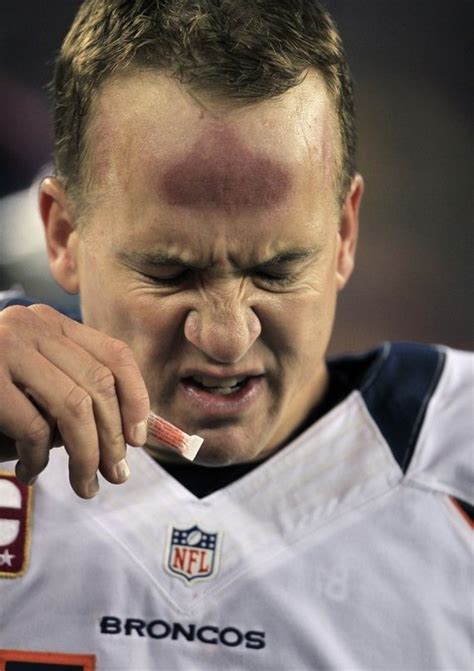 The indianapolis colts unveiled a statue of former quarterback peyton manning outside lucas oil stadium on saturday. What Is Wrong With Peyton Manning's Forehead? - Barnorama