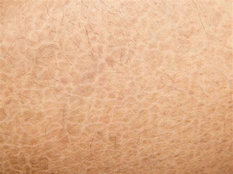 Skin Disorders Causes And Treatments Eczema Life