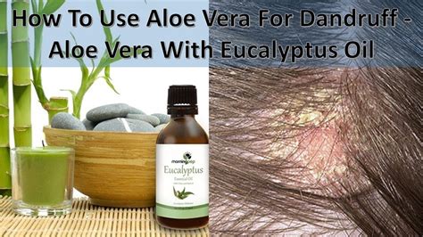 How To Use Aloe Vera For Dandruff Aloe Vera With Eucalyptus Oil Youtube