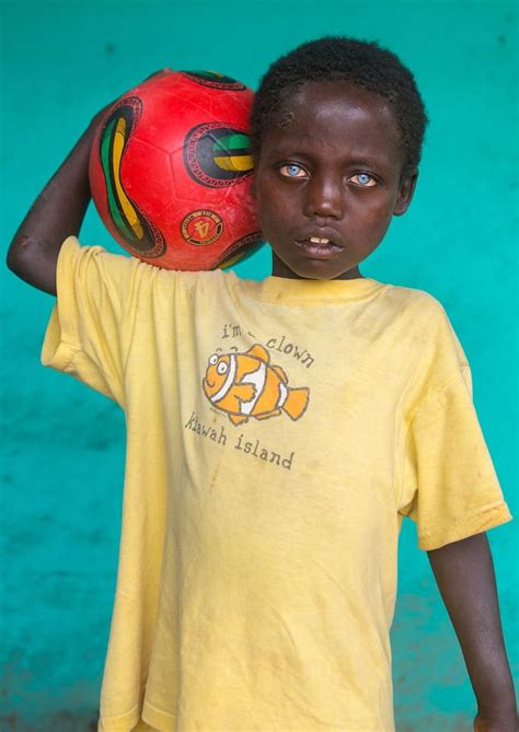 Ethiopian Boy Has Rare Bright Blue Eyes That Make Him Unique Bright