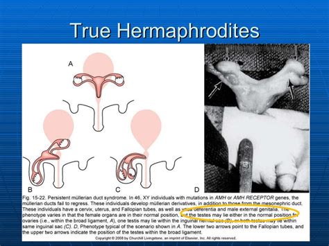 difference between hermaphrodite and intersex definition