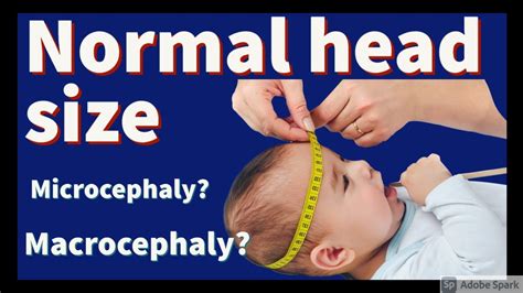 Session 4 Normal Head Size Microcephaly And Macrocephaly Youtube