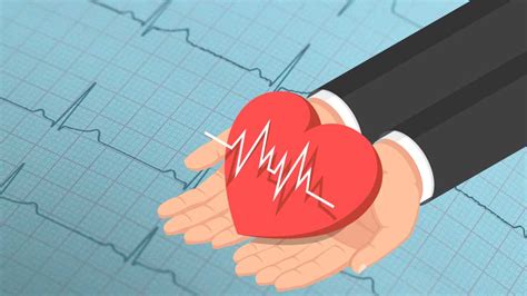 5 Lead Ecg Placement And Cardiac Monitoring Ausmed