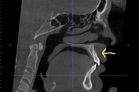 Cone Beam Ct Imaging Springfield Mo Dentist Buzbee Dental