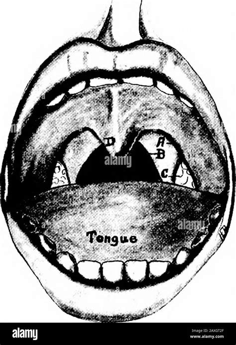 Oral vestibule Black and White Stock Photos & Images - Alamy