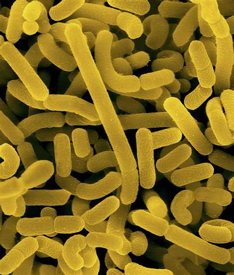Lactobacillus Acidophilus 3 Photograph By Dennis Kunkel Microscopy