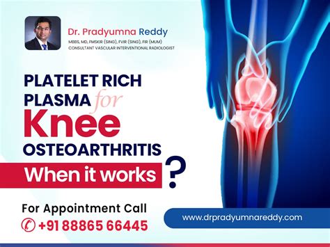 prp treatment for knee osteoarthritis when it works