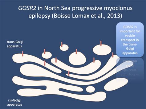 Gosr2 North Sea Myoclonus And The Haithabu Variant Beyond The Ion