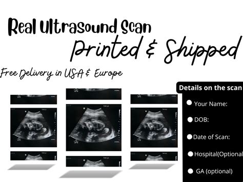 Pin on Fake Ultrasound Picture