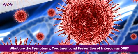 What Are The Symptoms Treatment And Prevention Of Enterovirus D68