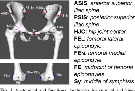 Figure 1 From Asis Anterior Superior Iliac Spine Psis Posterior