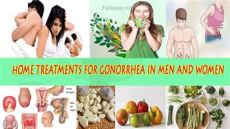 How To Deal With Gonorrhea Naturally Home Treatments For Gonorrhea In Men And Women