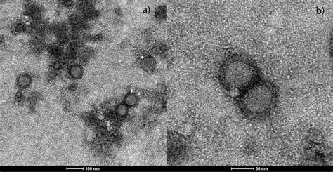 Togavirus Like Particles Observed With Transmission Electron Microscopy
