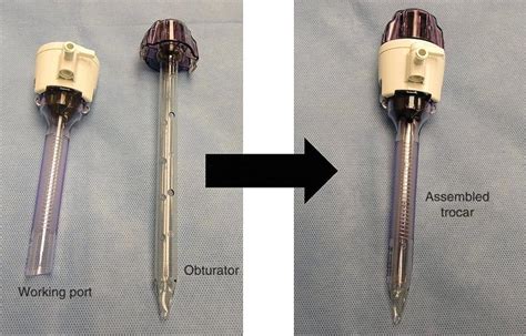 Laparoscopy Surgery Basic Instrumentation Abdominal Key