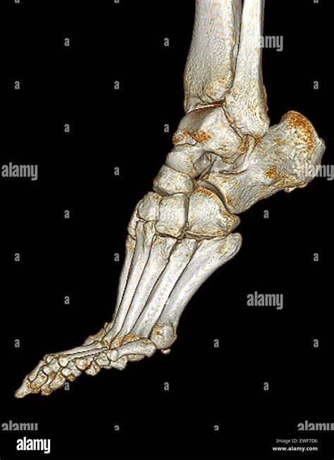 Foot Ct Scan Stock Photo Alamy