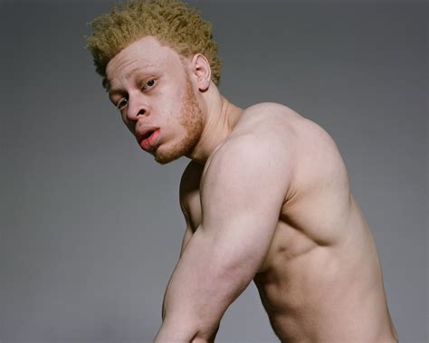 Nude Albino Telegraph