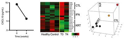 New Study Confirms JAK3 Effective in Alopecia Areata