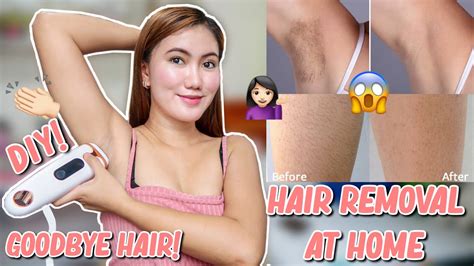 Safe & easy permanent hair removal smooth solutions is the los angeles inland empire area's premier permanent hair removal and electrolysis clinic. PINAKAMURANG DIY PERMANENT HAIR REMOVAL AT HOME - YouTube