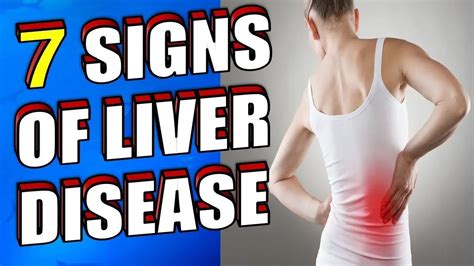 What Are The Early Signs Of Liver Disease 7 Symptoms You Should Know