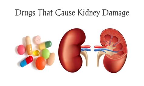 Top 10 Drugs That Cause Kidney Damage Meds Safety