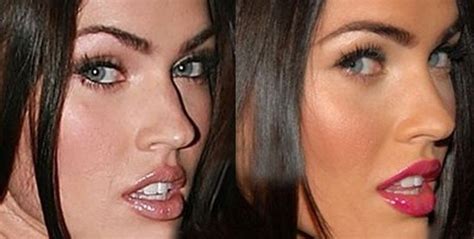 Whats The Truth About Megan Fox Plastic Surgery Claims