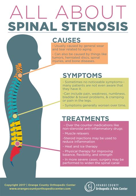 All About Spinal Stenosis Infographic Infographic Plaza