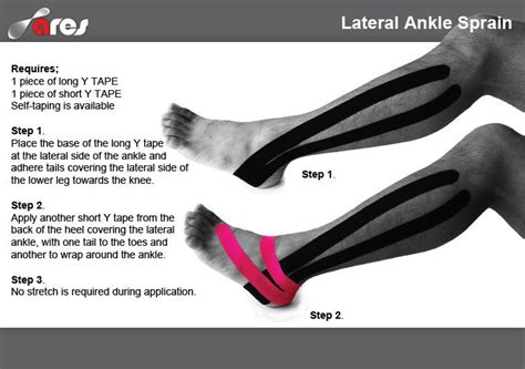 Lateral Ankle Sprain Ares Theratape Education Center Kinesiology