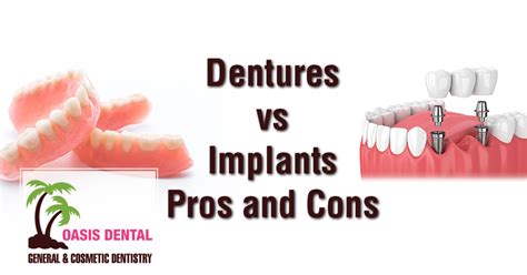 Dentures Vs Implants Pros And Cons Oasis Dental Blog Oasis Dental