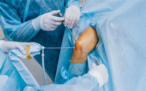 Unlocking The Potential Of Arthroscopy In Diagnosing And Treating