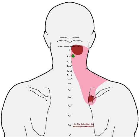 Understanding Trigger Points Pain At The Base Of The Head And Under