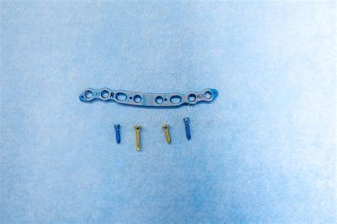 Explanted Titanium Plate And 4 Titanium Screws For The Treatment Of A