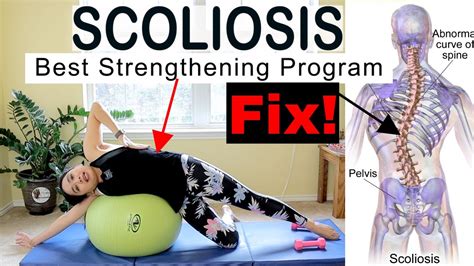 Scoliosis Best Strengthening Resistance Training Program Pilates Yoga Posture Fix Youtube