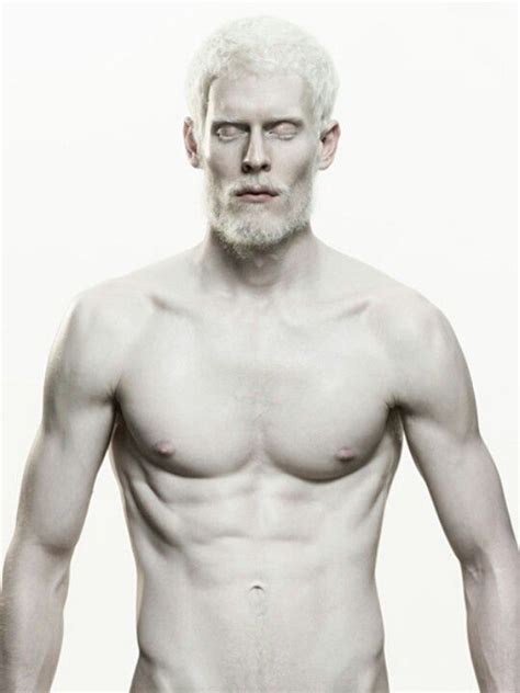 Stephen Thompson Model Albino Ilovehim Albino Human Stephen