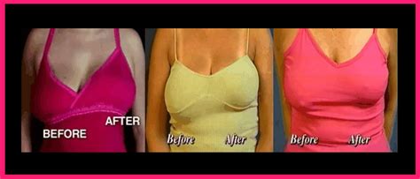 here is how to prevent sagging breasts naturally ~ style in life