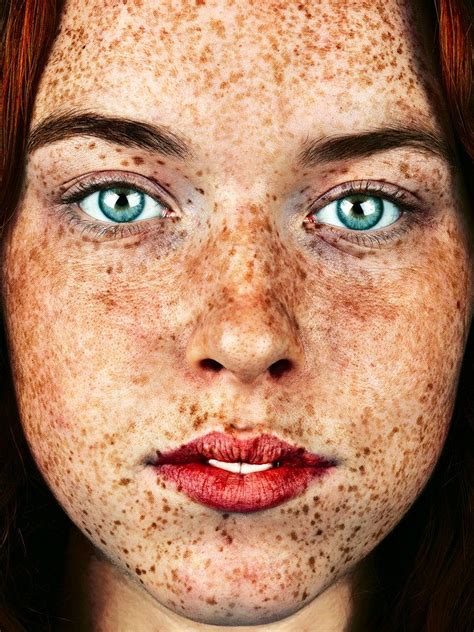 Freckles Are Gorgeous And These Photos Show Them In All Their Glory