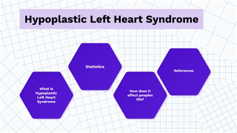 Hypoplastic Left Heart Syndrome By Tatjana Hanne