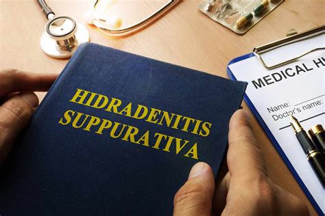 Hidradenitis Suppurativa Stages Symptoms Progression And More